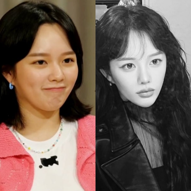 "성형설"까지 불러일으킨 정지소 날렵한 얼굴 턱선, 대체 뭘 했길래?