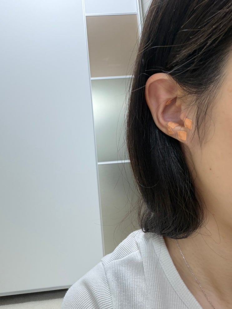  귀지압패치 붓기 관리와 두통 관리에 좋아서 추천해요(다이어트 도움)