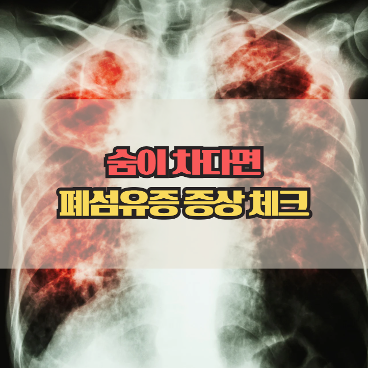  폐섬유증 증상과 원인, 초기에는 이렇게 시작됩니다