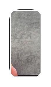 김포 구래치과 임플란트 재수술 즉시 확인해봐야