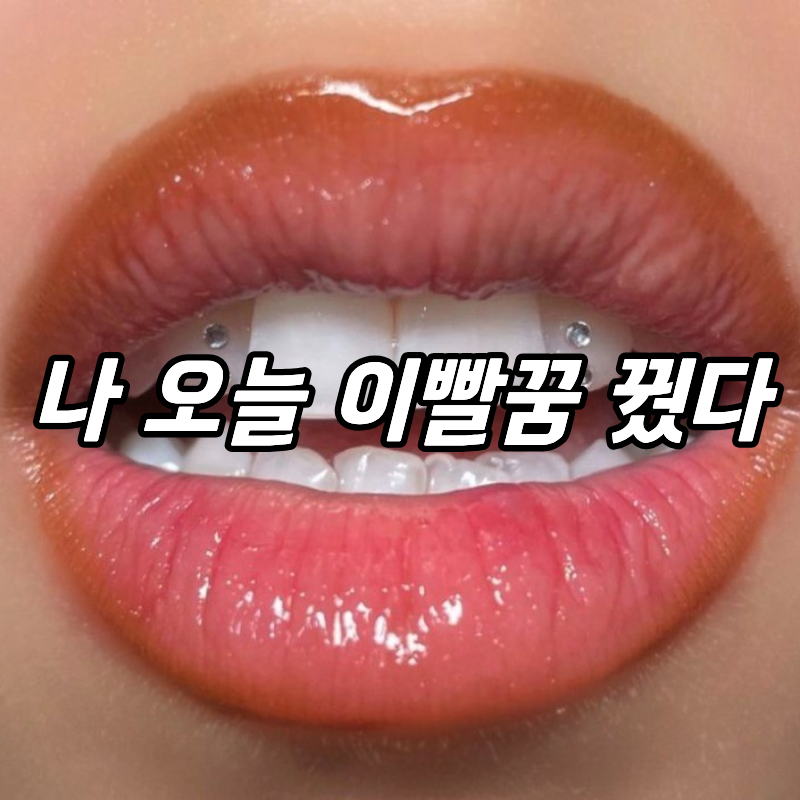 이빨 빠지는 꿈 해몽 10가지 총정리, 불길한건가? (윗니, 아랫니, 어금니 상황별 풀이)