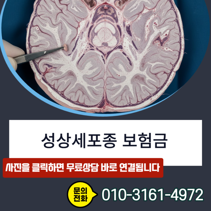  성상세포종 보험금 D43 코드라도일반암 고액암 지급받는 필살기