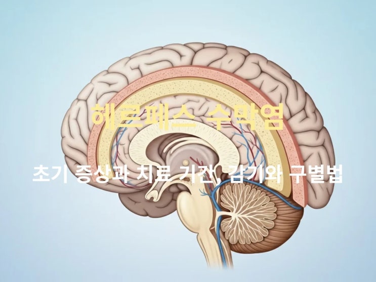  헤르페스 수막염 초기 증상과 치료 기간, 감기와 구별법