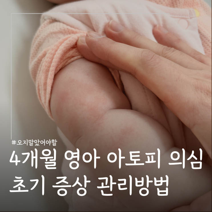  4개월 아기 피부 붉은 발진 ㅣ아토피성피부염 증상 관리방법
