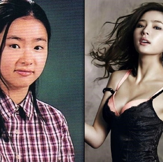 신세경 옆모습 성형 전후 과거 비교 — 사실과 루머 분리 정리