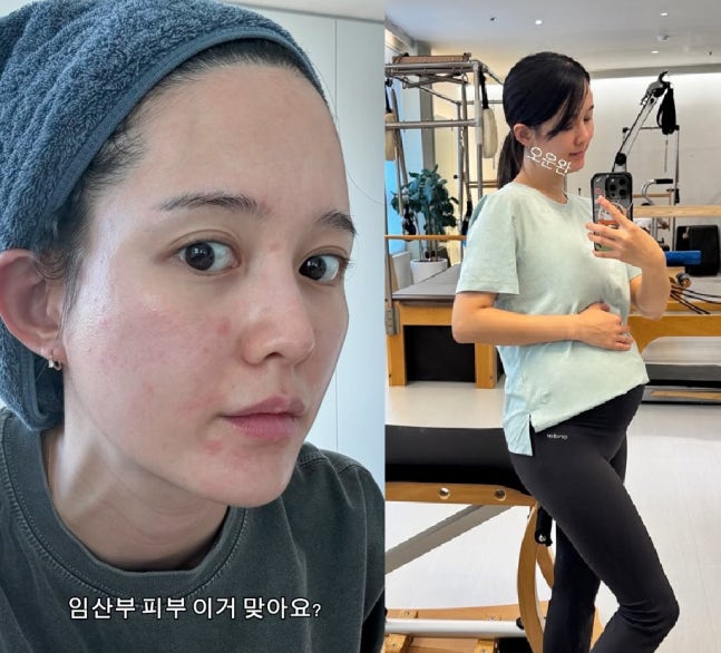  남보라 임신 21주차 근황 공개! 53kg D라인·임산부 피부 트러블 고백… 6월 출산 앞두고 솔직 일상 (+편스토랑)