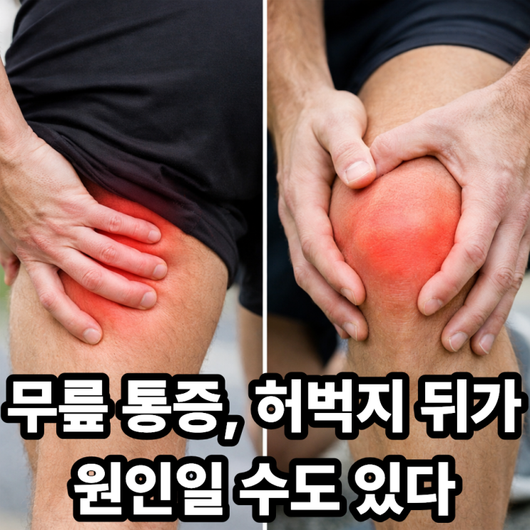  햄스트링과 무릎 통증의 연관성, 의외로 깊은 관계