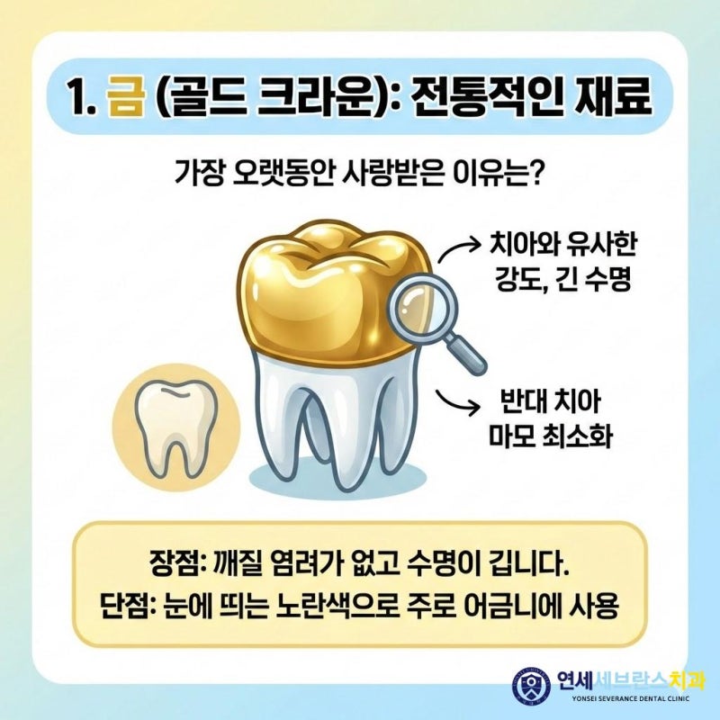 어금니 크라운 종류, 어떤 기준으로 선택해야 할까?