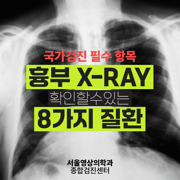  광주역동 흉부엑스레이 검사로 알 수 있는 질환