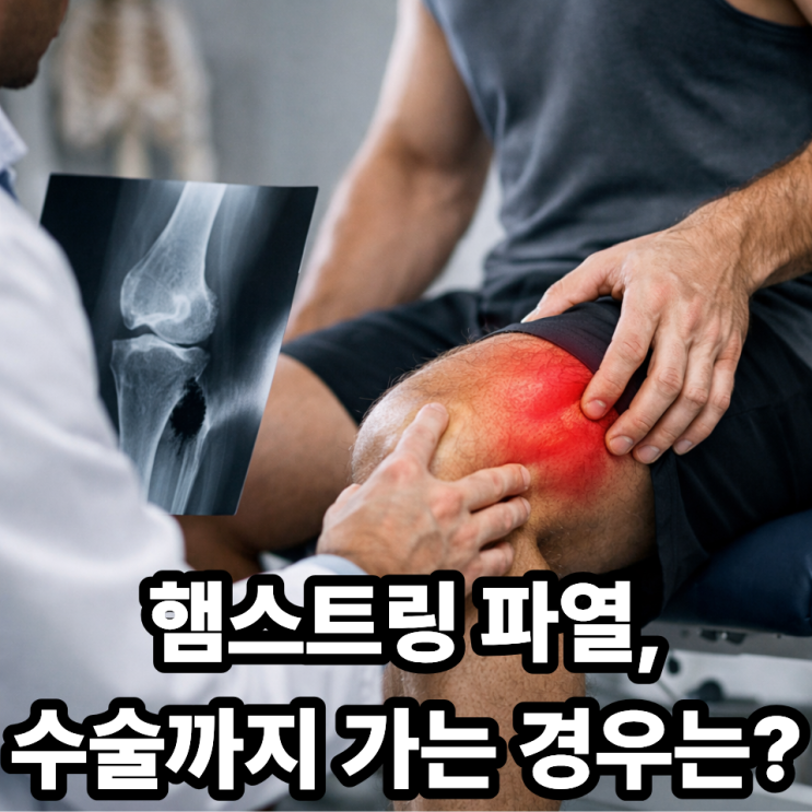  햄스트링 수술이 필요한 경우는 언제? 파열 단계별 정리