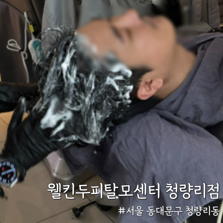  [서울 동대문] 청량리두피관리 전문센터, ‘웰킨두피탈모센터 청량리점’ 솔직리뷰