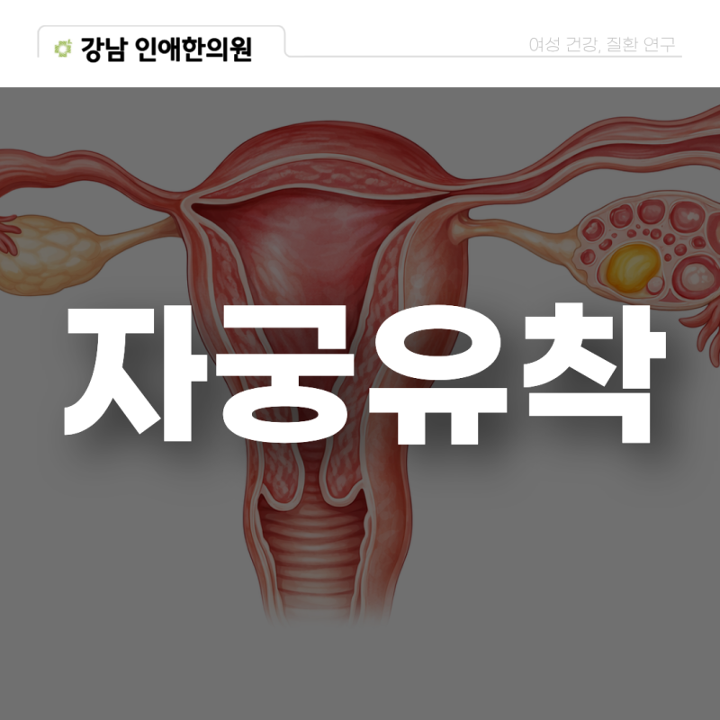 자궁유착 증상 치료 박리술 회복 임신에도 영향 있을까?