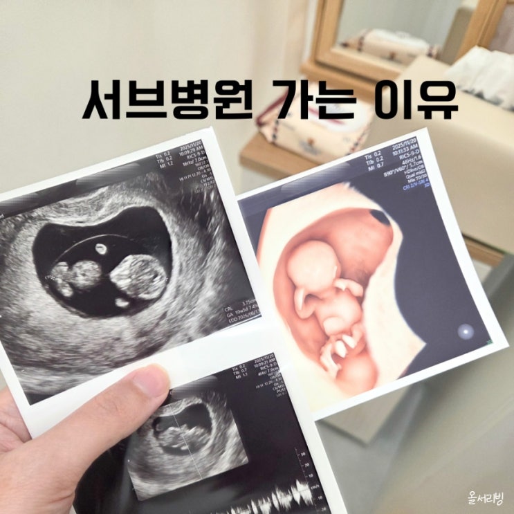  임산부 산부인과 서브병원 뜻 가는이유 초음파 가격 횟수