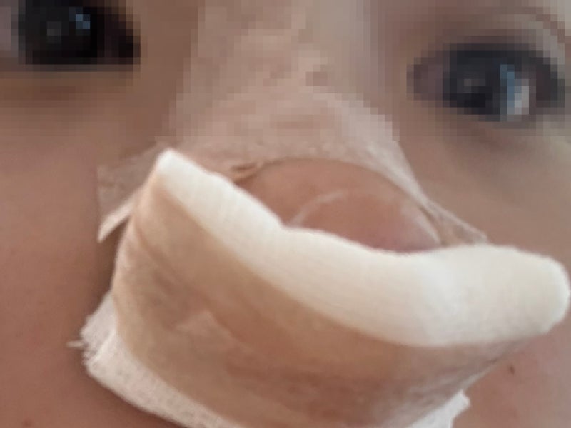 비중격만곡증 + 비염수술 솜제거 통증 준비물 총정리 (직접 겪은 솔직후기 1편)