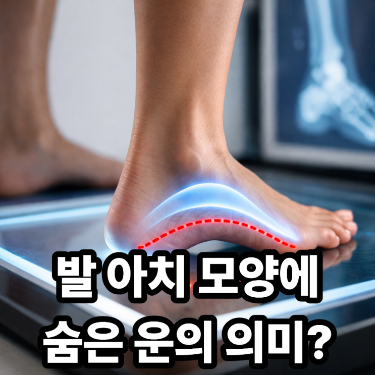  족상에서 발 아치 모양이 뜻하는 것, 운의 균형을 말해줄까?