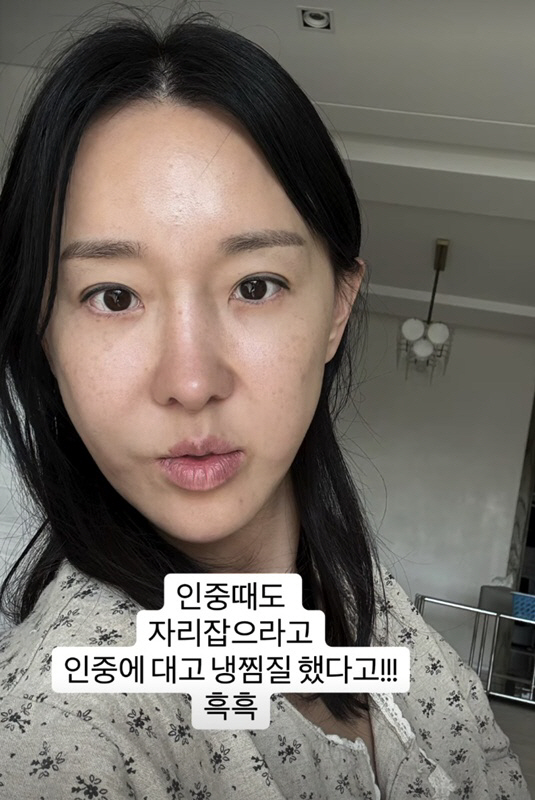 이지혜, '46세' 적나라한 '인중축소술' 직후 입 못 다문 채 '냉찜질' ....