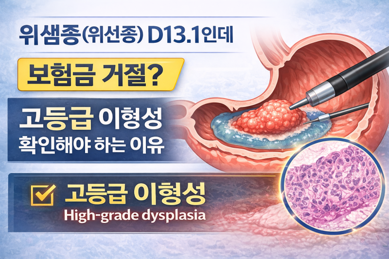 위선종 D13.1 제자리암 보험금 가능할까? 고등급 위샘종 병리결과가 핵심입니다