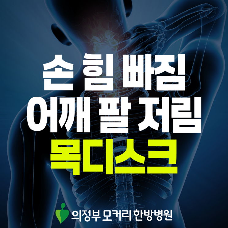  의정부 목디스크 치료, 팔 저림이 계속된다면 살펴봐야 할 점