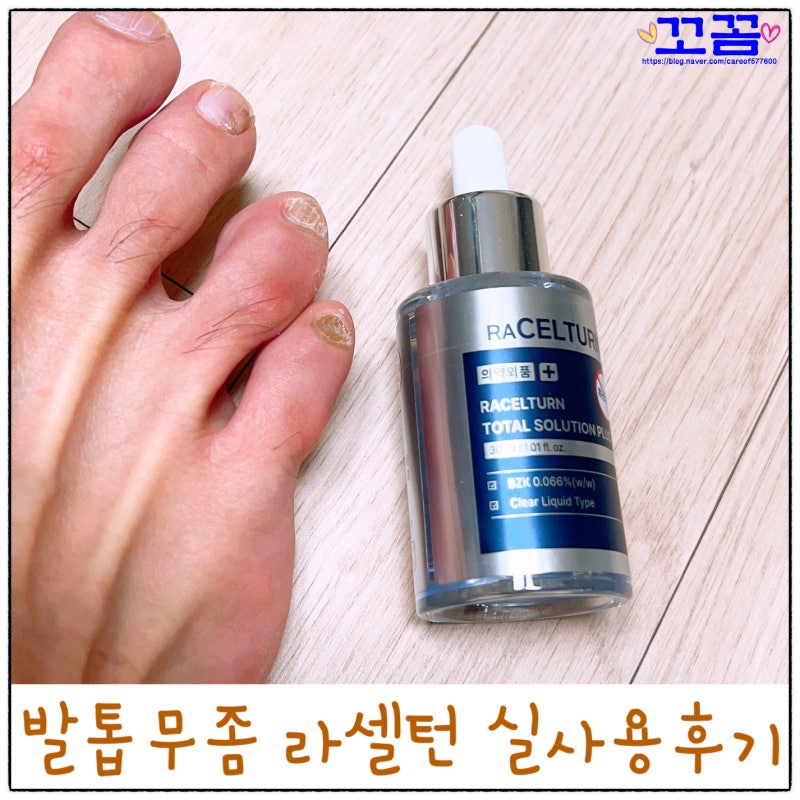 발톱무좀약 라셀턴 15일차 실제후기