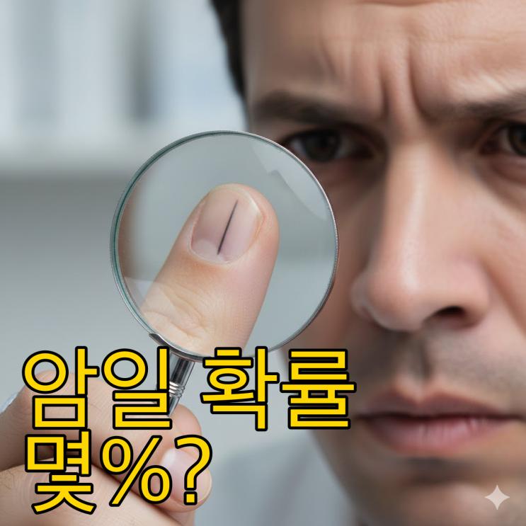  손톱 검은 세로줄, 흑색종일까? 놓치면 안 되는 위험신호 5가지
