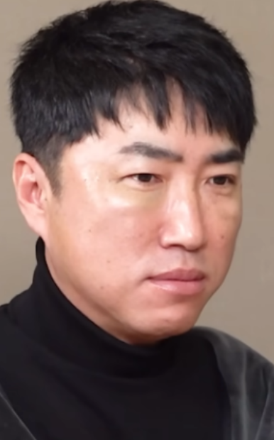   ‘46세’ 장동민, “눈·코 뚫어 당겼다”... 퉁퉁 부은 얼굴로 전한 실리프팅 ‘리얼’ 후기