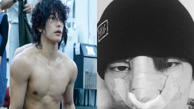  육준서, 복싱 중 코뼈 골절→재건 수술 완료… "당분간 그림에 집중할 것"