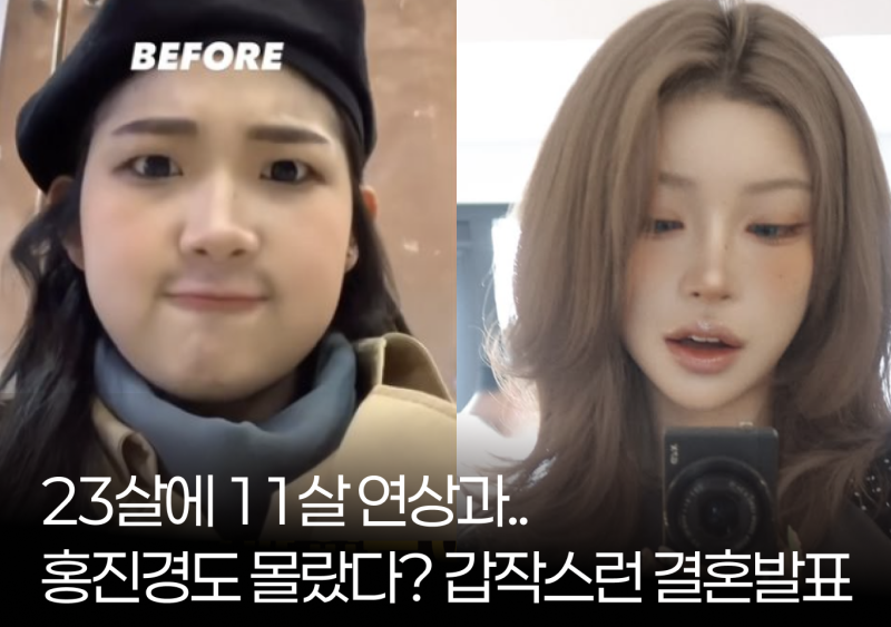 "22살에 결혼 발표..." 최진실 딸 최준희,  웨딩화보 속 뼈말라 몸매, 골반 괴사도 이겨낸 관리....