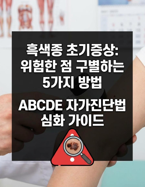 흑색종 초기증상, 위험한 점 구별하는 5가지 방법 (ABCDE 자가진단법 완전정리)