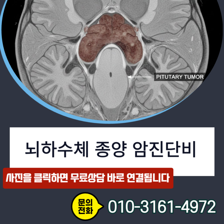  뇌하수체 종양 암진단비 , D35.2 양성 코드라도 전액 수령하는 핵심전략 포인트