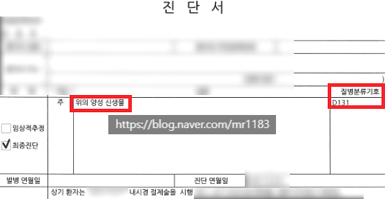 D131 위의 양성신생물 암보험금 받을 수 있습니다