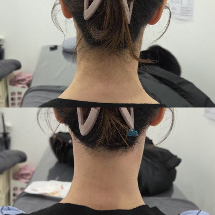  인천 논현동 왁싱 뒷목왁싱 후기 저통증 왁싱샵 비엘왁싱 트러블관리는 어떻게