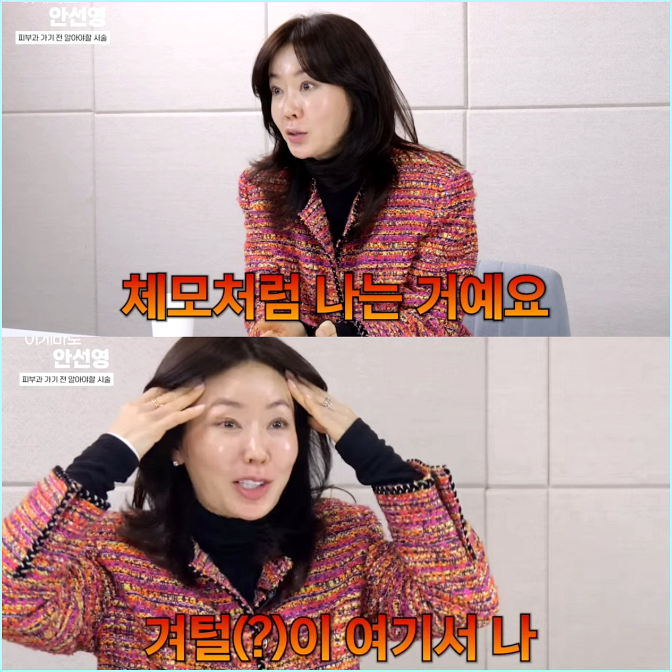  "이마에서 겨털이 자라요" 안선영 성형 폭망 고백, 결혼식 전 대체 무슨 일이?