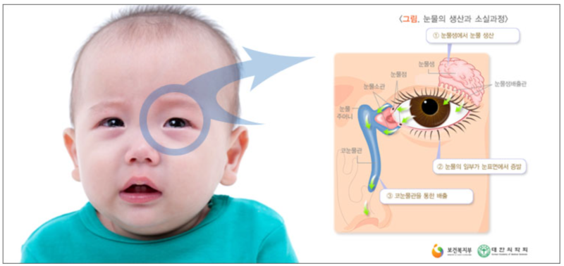 (초보맘 필독) 신생아 눈곱, 혹시 눈물샘 막힘? 증상부터 뻥 뚫는 마사지까지!