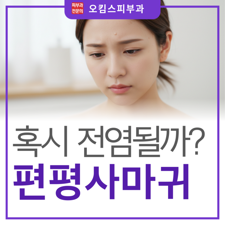  마두동피부과 편평사마귀 옮나요? 꼭 알아야 할 전염성과 예방법