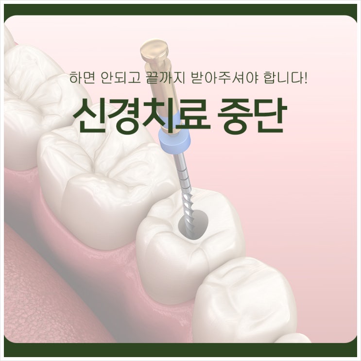  신경치료 중단, 하면 안되고 끝까지 받아주셔야 합니다!