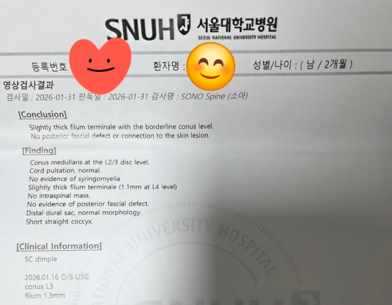신생아딤플/서울대이지연교수님/최종후기