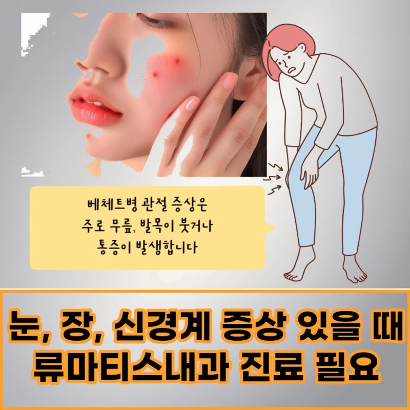 서울 서초 베체트병 유전적인 요인이 발병에 미치는 영향은?