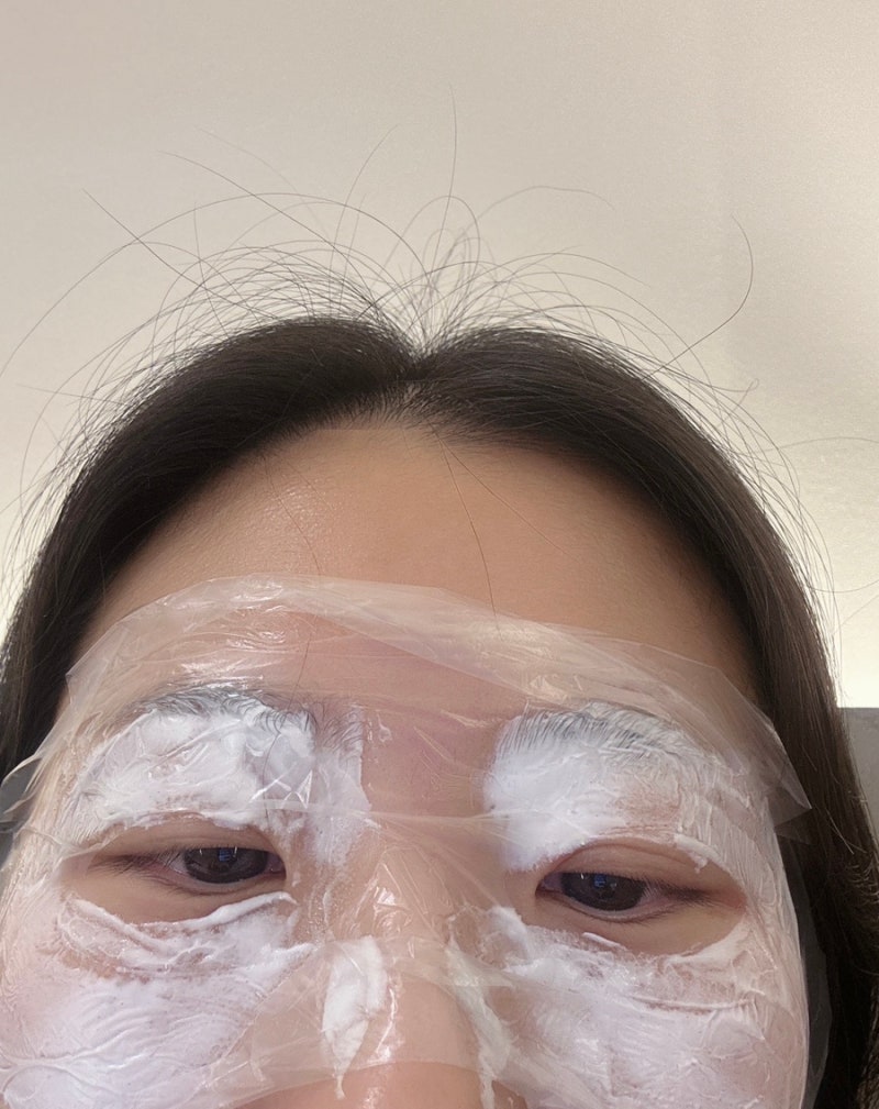 한관종 재발 아그네스 시술 제거 후기 세안, 재생크림 등 많은 정보 공유