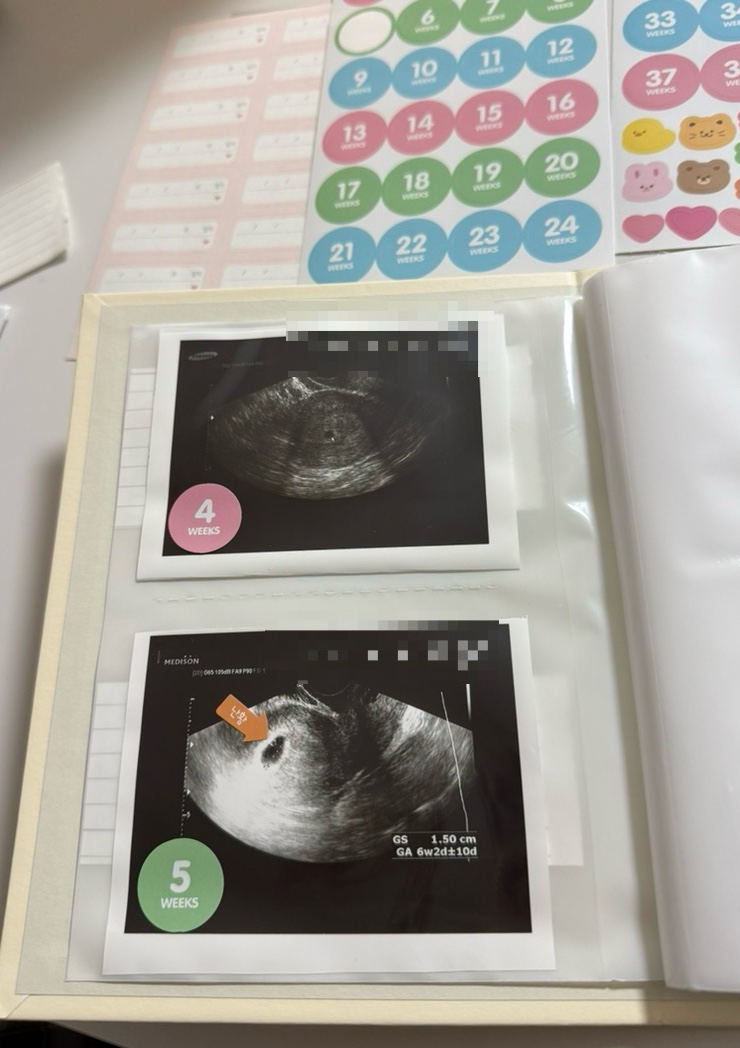  [임신 5주차 증상] 아기집, 난황 확인 / 임신확인서 발급 후 해야할 일 / 보건소 임산부 등록 / 맘편한 임신, 우체국 엄마 보험, 국가바우처