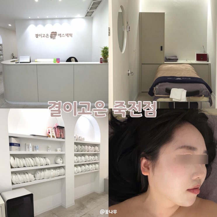 대구죽전 에스테틱 결이고은 작은얼굴 관리 후기