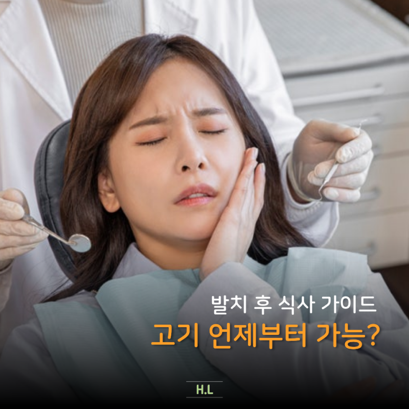 발치했는데 삼겹살 생각 난다고? 사랑니 발치 후 식사 이렇게 하면 고기 빨리 먹습니다