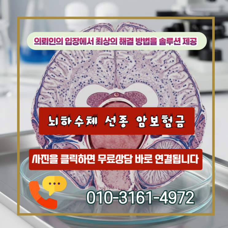 뇌하수체 선종 암보험금,D35.2 코드라도 전액 보상받을수 있는 전략
