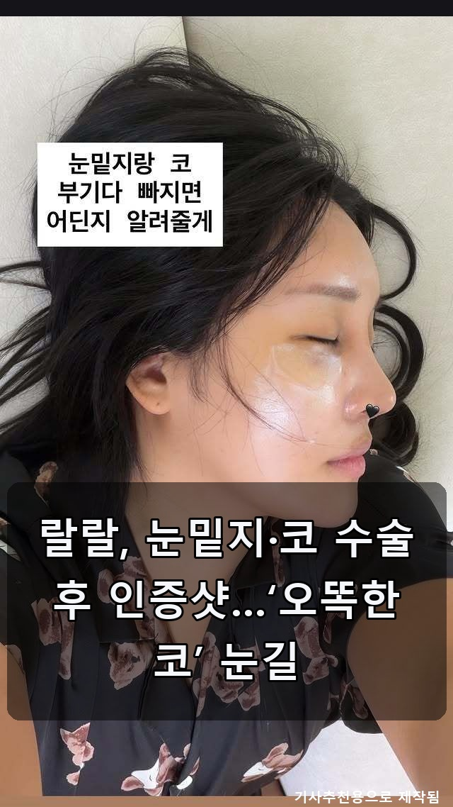 랄랄 코 성형, 이민정 눈물, 뷰티풀너드 결혼! 핫이슈 한 번에 싹- 정리! ✨
