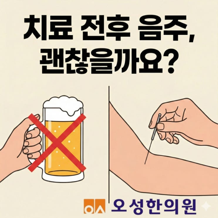 침 맞고 술 마셔도 되나요? 치료 전후 음주 가이드