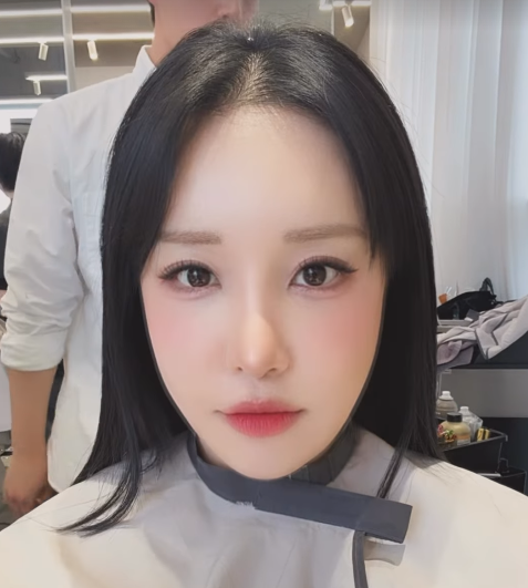  부기 빠지며 드러난 아름다운 모습 보여준 랄랄, 눈코 성형 후 변화