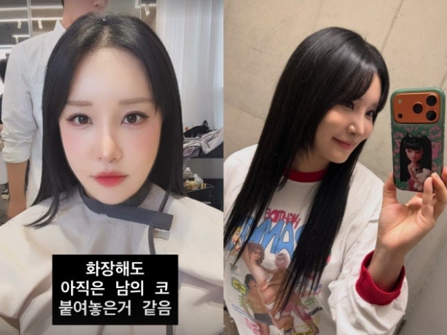 랄랄, 눈코 성형 후 변화, 수술 1주차 확 달라진 근황 공개