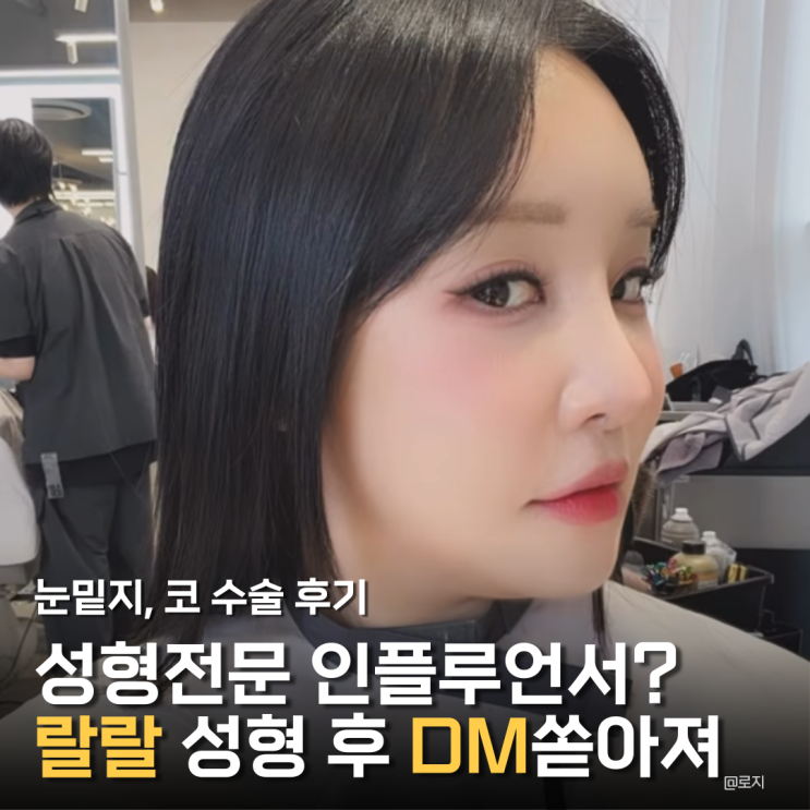  랄랄 눈밑지 코 성형 후 인스타그램에 얼굴 공개