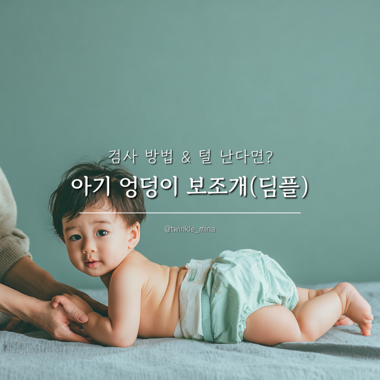  신생아 딤플 아기 엉덩이 보조개 검사 방법 털 있다면?