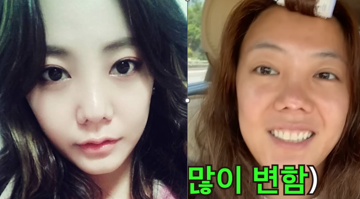 "성형 실패라고요?"… 고은아 코가 변한 진짜 이유