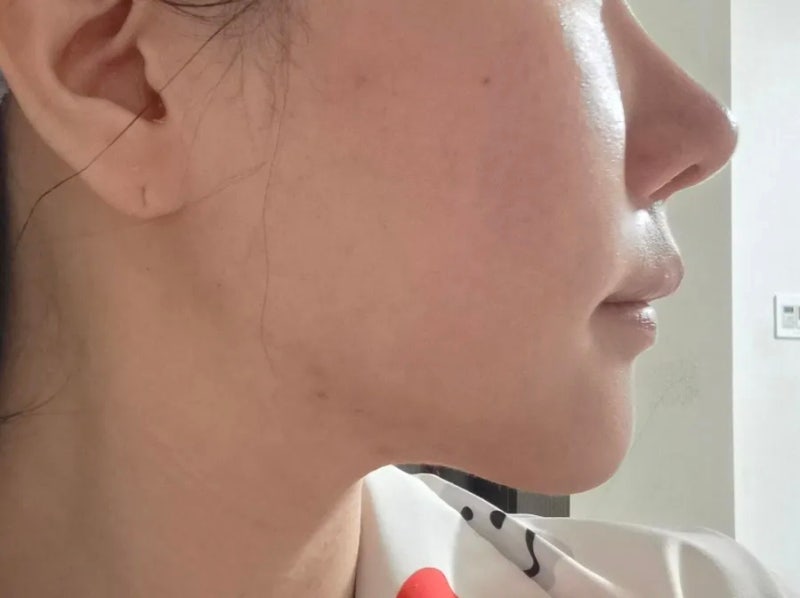 올리브영 리프팅팩추천 4종 비교! 턱라인부터 붓기까지 홈케어 솔직후기